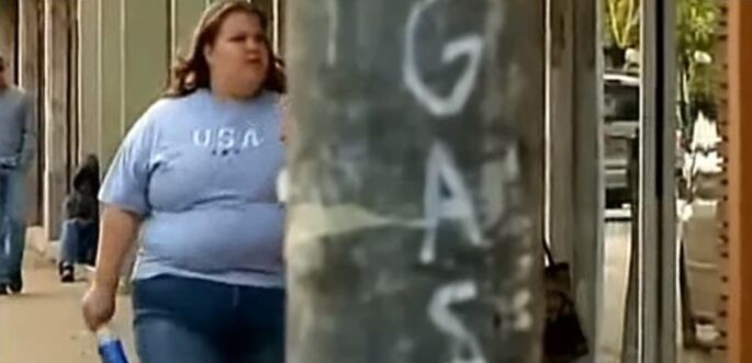 Exceso de peso a causa das varices
