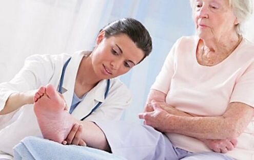 Consultar a un médico se tes síntomas de varices